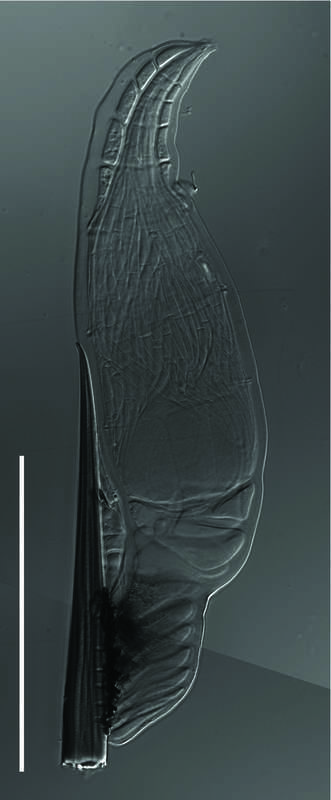 Female thallus of Herpomyces chaetophilus from a Periplaneta americana cockroach, collected on July 25 2014 in the basement of the Farlow Herbarium of Cryptogamic Botany, Harvard University, Cambridge, Massachusetts, USA. Scale bar 100 μm.